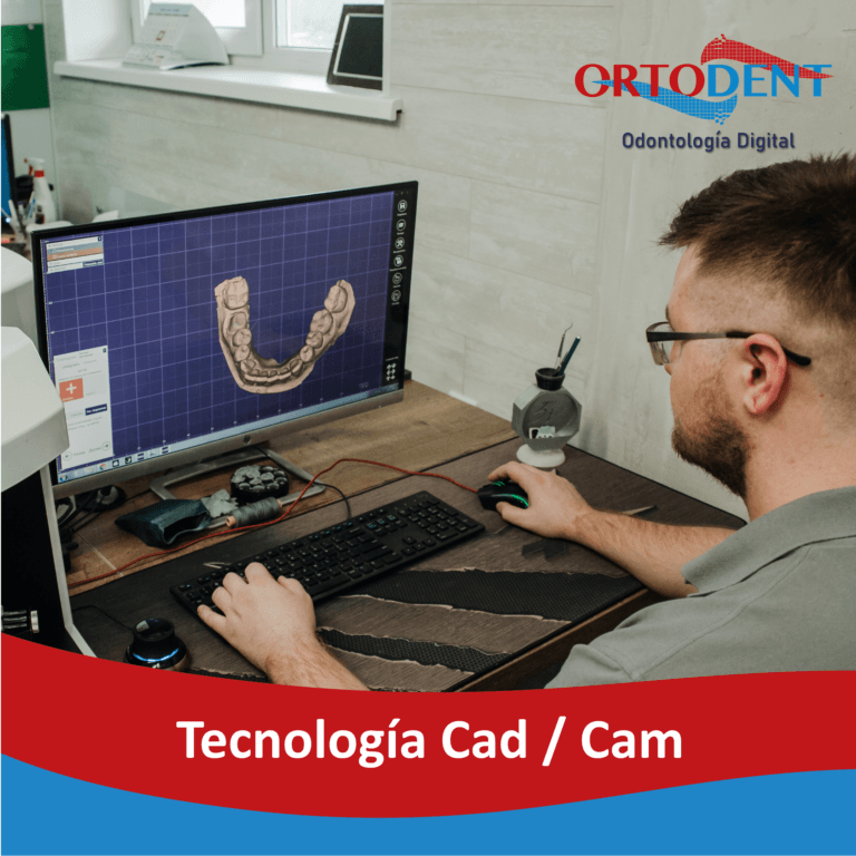 Tecnología cad cam