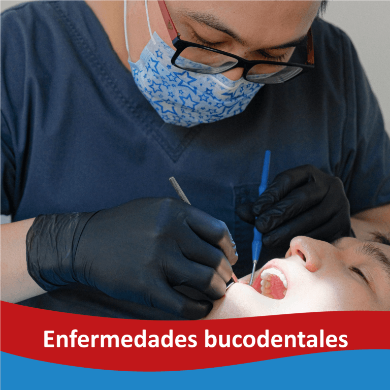 Enfermedades bucales
