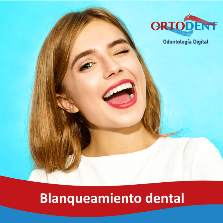 Blanqueamiento dental