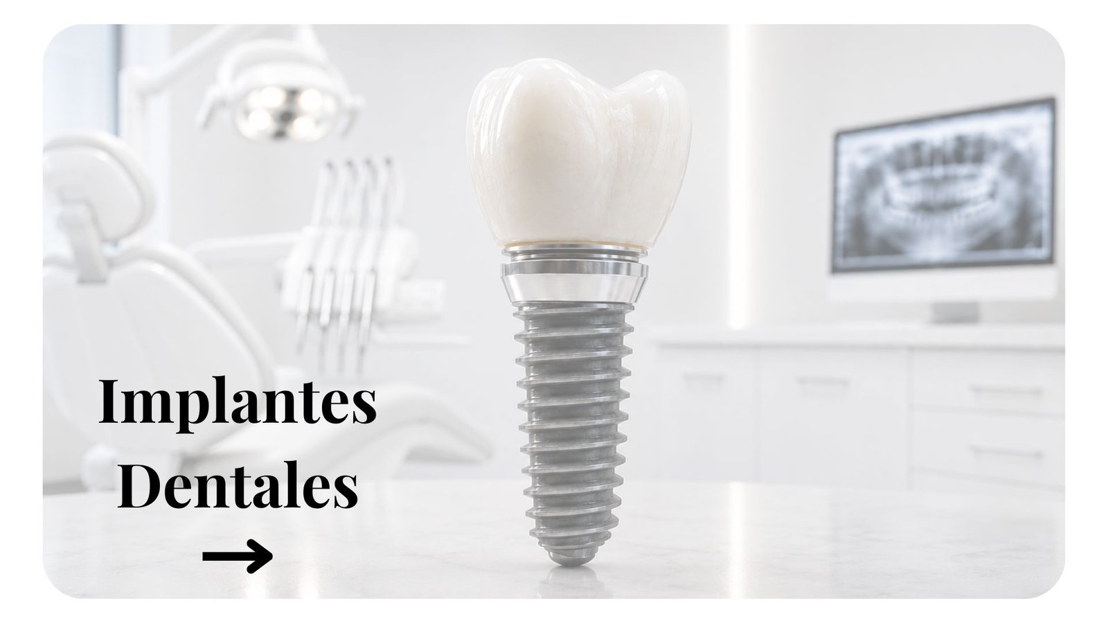 Implantes dentales