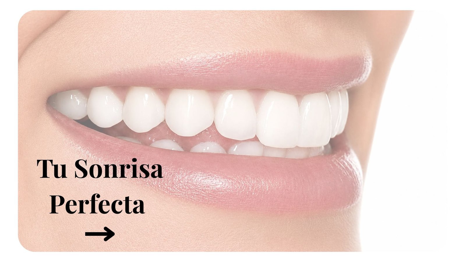 Diseño de sonrisa