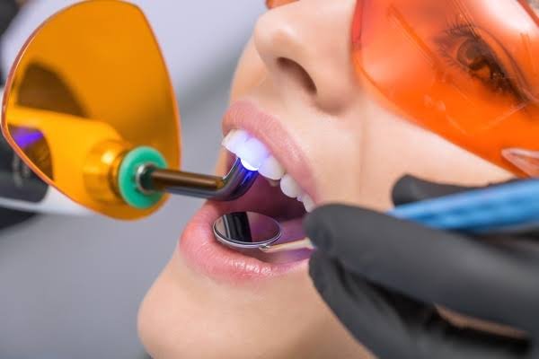 Odontología Láser